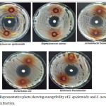 Figure 1: Representative photo showing susceptibility of S. epidermidis and S. aureus to the chloroform fraction.