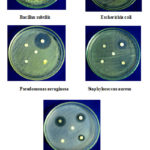 Figure 1: Zone of inhibition of moieties 1-4 against B