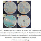 Antimicrobial activity. Pseudomonas aeruginosa факторы патогенности. Pseudomonas aeruginosa микробиологическая диагностика. Псевдомонас аэругиноза антибиотики. Pseudomonas aeruginosa микробиология размер.