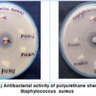 Vol37No3_Ant_Jeb_fig1A-140x140.jpg